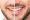 reabilitacao-oral-antonio-dente-4
