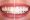 reabilitacao-oral-antonio-dente-5